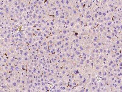 Immunohistochemistry-Paraffin: FcgR4/CD16-2 Antibody [NBP3-05901]