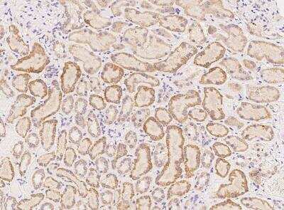 Immunohistochemistry-Paraffin: Fer-1-like protein 6 Antibody [NBP3-05936]