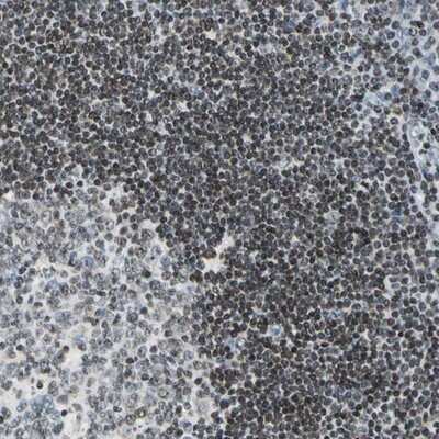 Immunohistochemistry-Paraffin: Fer Antibody [NBP1-86894]