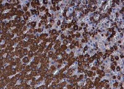 Immunohistochemistry-Paraffin: Ferredoxin Reductase Antibody [NBP2-16468]