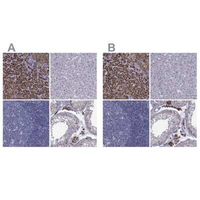 Immunohistochemistry-Paraffin: Ferredoxin Reductase Antibody [NBP2-38530]