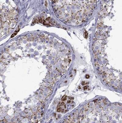 Immunohistochemistry-Paraffin: Ferredoxin Reductase Antibody [NBP2-38530]