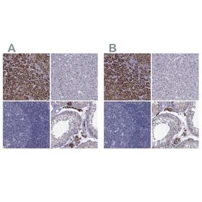 Immunohistochemistry-Paraffin: Ferredoxin Reductase Antibody [NBP2-38706]