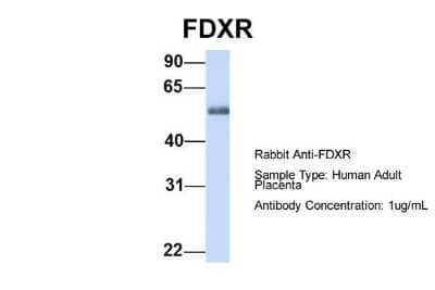 Western Blot: Ferredoxin Reductase Antibody [NBP1-54789]