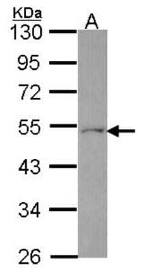 Western Blot: Ferredoxin Reductase Antibody [NBP2-16467]