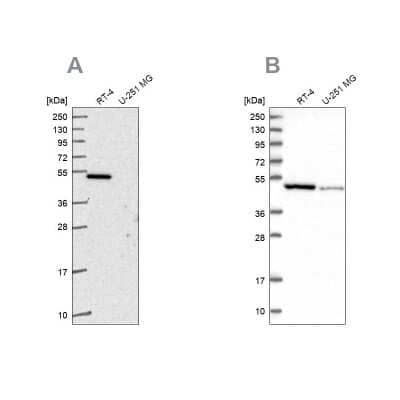 Western Blot: Ferredoxin Reductase Antibody [NBP2-38706]