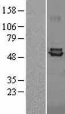 Western Blot: Ferredoxin Reductase Overexpression Lysate [NBL1-10672]