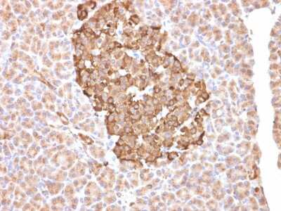 Immunohistochemistry-Paraffin: Ferritin Antibody (FTH/2081) - Azide and BSA Free [NBP3-08581]