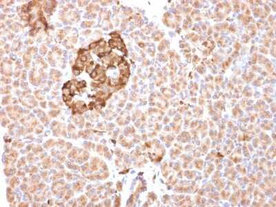 Immunohistochemistry-Paraffin: Ferritin Heavy Chain Antibody (FTH/2081) - Azide and BSA Free [NBP3-08581]