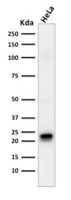 Western Blot: Ferritin Antibody (FTH/2081) [NBP3-07795]