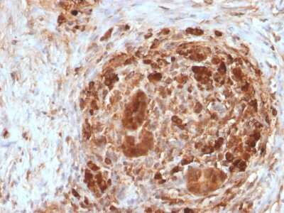Immunohistochemistry-Paraffin: Ferritin Heavy Chain Antibody (FTH/2082) [NBP3-07799]