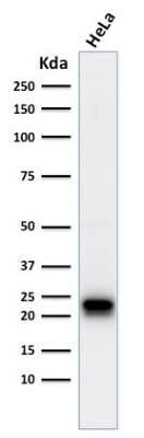 Western Blot: Ferritin Antibody (FTH/2082) [NBP3-07799]