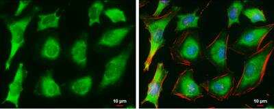 Immunocytochemistry/ Immunofluorescence: Ferritin Heavy Chain Antibody [NBP1-31944]