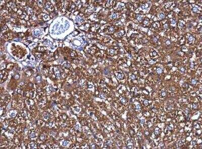 Immunohistochemistry-Paraffin: Ferritin Heavy Chain Antibody [NBP1-31944]