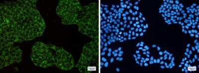 Immunocytochemistry/ Immunofluorescence: Ferritin Heavy Chain Antibody (S03-3D9) [NBP3-15028]