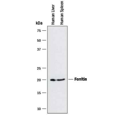 Western Blot: Ferritin Antibody (962610)Azide and BSA Free [MAB9354]