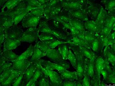 Immunocytochemistry/ Immunofluorescence: Ferritin Heavy Chain Antibody [NBP1-06985]