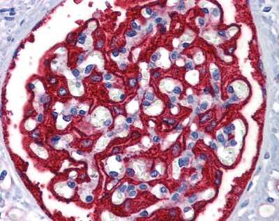 Immunohistochemistry: Ferritin Heavy Chain Antibody [NBP3-09324]