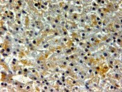 Immunohistochemistry-Paraffin: Ferritin Heavy Chain Antibody [NBP1-06985]