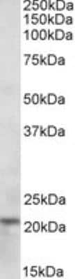 Western Blot: Ferritin Heavy Chain Antibody [NBP1-06985]