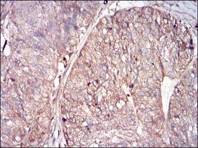 Immunohistochemistry: Ferritin Light Chain Antibody (6E10E4) - BSA Free [NBP2-37250]
