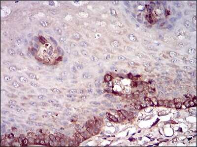 Immunohistochemistry: Ferritin Light Chain Antibody (6E10E4) - BSA Free [NBP2-37250]