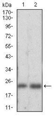 Western Blot: Ferritin Light Chain Antibody (6E10E4)BSA Free [NBP2-37250]