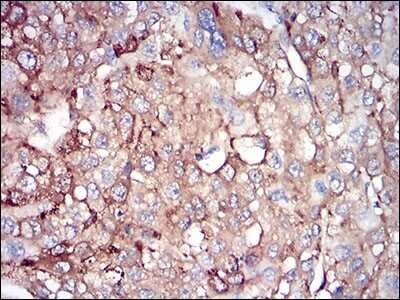 Immunohistochemistry: Ferritin Light Chain Antibody (8E1E7) - BSA Free [NBP2-37243]