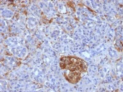 Immunohistochemistry-Paraffin: Ferritin Light Chain Antibody (FTL/1386) - Azide and BSA Free [NBP2-54574]