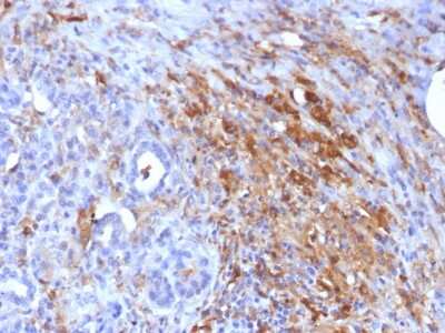 Immunohistochemistry-Paraffin: Ferritin Light Chain Antibody (FTL/1386) - Azide and BSA Free [NBP2-54574]
