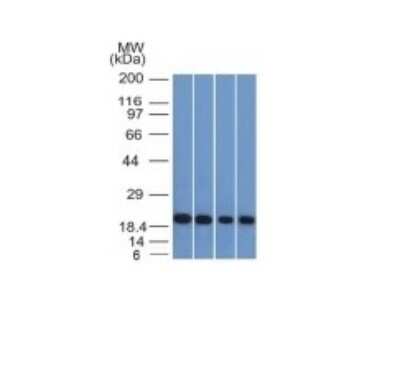 Western Blot: Ferritin Light Chain Antibody (FTL/1386)Azide and BSA Free [NBP2-54574]