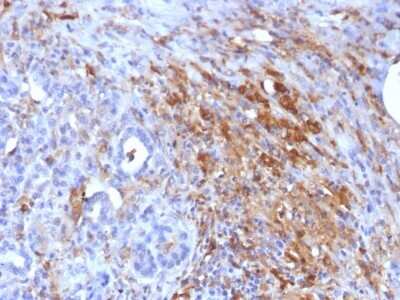 Immunohistochemistry-Paraffin: Ferritin Light Chain Antibody (FTL/1386) [NBP2-53295]