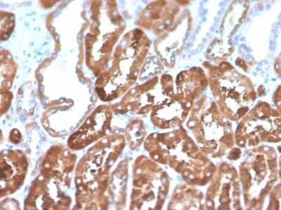Immunohistochemistry-Paraffin: Ferritin Light Chain Antibody (FTL/1386) [NBP2-53295]