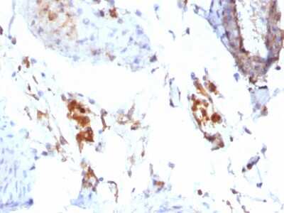 Immunohistochemistry-Paraffin: Ferritin Light Chain Antibody (FTL/1386) [NBP2-53295]
