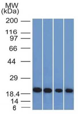 Western Blot: Ferritin Light Chain Antibody (FTL/1386) [NBP2-53295]