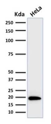 Western Blot: Ferritin Light Chain Antibody (FTL/1386) [NBP2-53295]