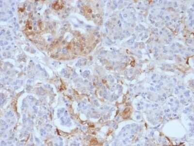 Immunohistochemistry-Paraffin: Ferritin Light Chain Antibody (FTL/1388) [NBP2-53296]
