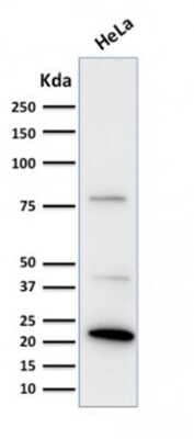 Western Blot: Ferritin Light Chain Antibody (FTL/1388) [NBP2-53296]