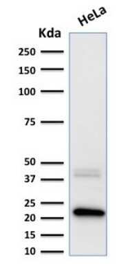 Western Blot: Ferritin Light Chain Antibody (FTL/1389)Azide and BSA Free [NBP2-54583]