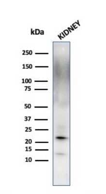 Western Blot: Ferritin Light Chain Antibody (FTL/1389)Azide and BSA Free [NBP2-54583]