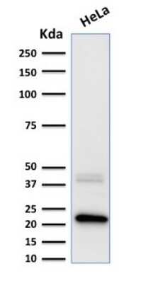 Western Blot: Ferritin Light Chain Antibody (FTL/1389) [NBP2-53297]