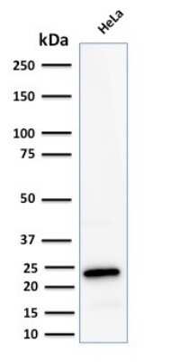 Western Blot: Ferritin Light Chain Antibody (FTL/2338R) [NBP3-07804]