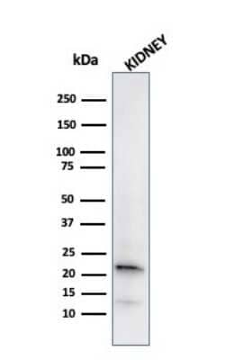 Western Blot: Ferritin Light Chain Antibody (FTL/2338R) [NBP3-07804]