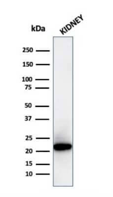 Western Blot: Ferritin Light Chain Antibody (FTL/3872R)Azide and BSA Free [NBP3-08623]