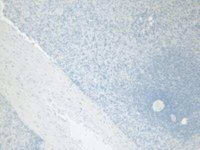 Immunohistochemistry: Ferritin Light Chain Antibody [NBP1-06986]