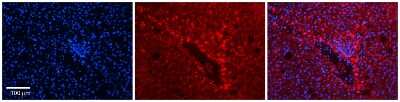 Immunohistochemistry: Ferritin Light Chain Antibody [NBP1-54948]