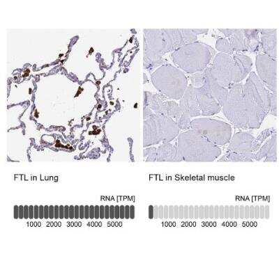 Immunohistochemistry-Paraffin: Ferritin Light Chain Antibody [NBP2-34072]