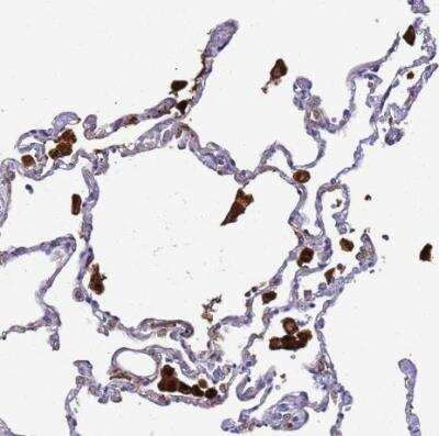 Immunohistochemistry-Paraffin: Ferritin Light Chain Antibody [NBP2-34072]