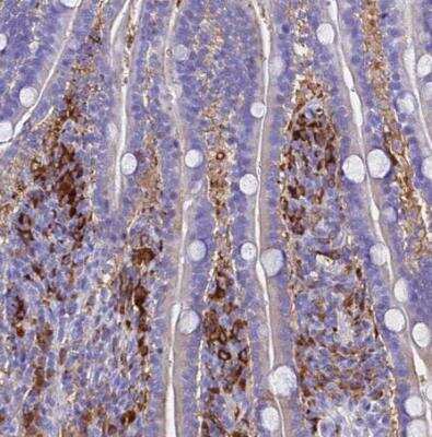 Immunohistochemistry-Paraffin: Ferritin Light Chain Antibody [NBP2-34072]