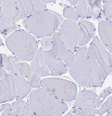 Immunohistochemistry-Paraffin: Ferritin Light Chain Antibody [NBP2-34072]